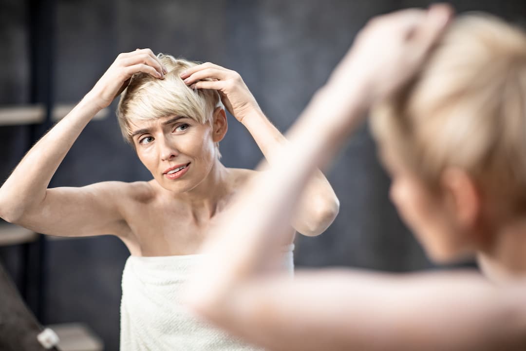 Femme avec pellicules qui va utiliser un shampoing antipelliculaire