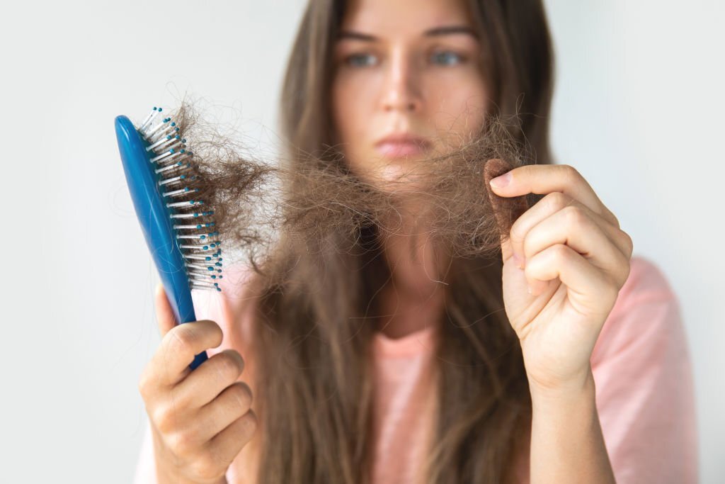 Alopécie : Comment lutter contre la chute de cheveux ?