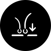 Chute de Cheveux